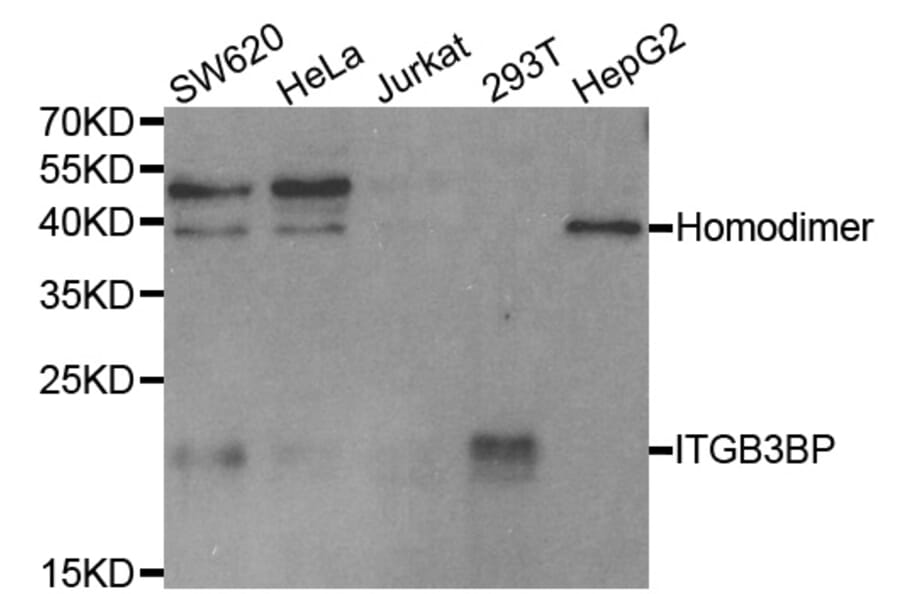 Western blot - ITGB3BP Antibody from Signalway Antibody (33078) - Antibodies.com