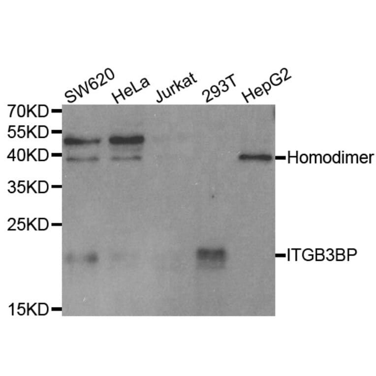 Western blot - ITGB3BP Antibody from Signalway Antibody (33078) - Antibodies.com