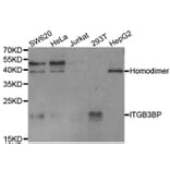 Western blot - ITGB3BP Antibody from Signalway Antibody (33078) - Antibodies.com
