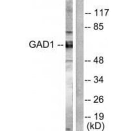 Western blot - GAD1/2 Antibody from Signalway Antibody (33381) - Antibodies.com