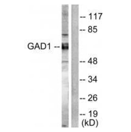 Western blot - GAD1/2 Antibody from Signalway Antibody (33381) - Antibodies.com