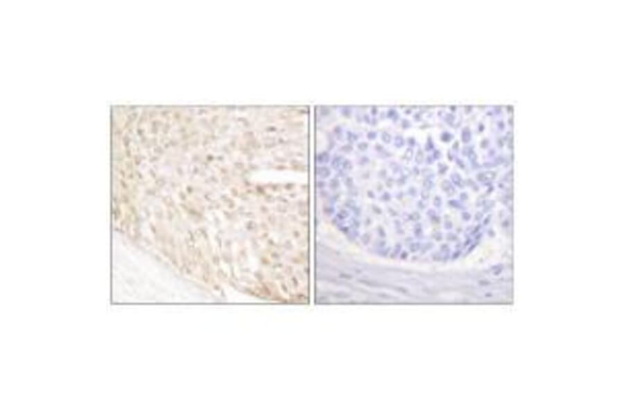 Immunohistochemistry - p18 INK Antibody from Signalway Antibody (33458) - Antibodies.com