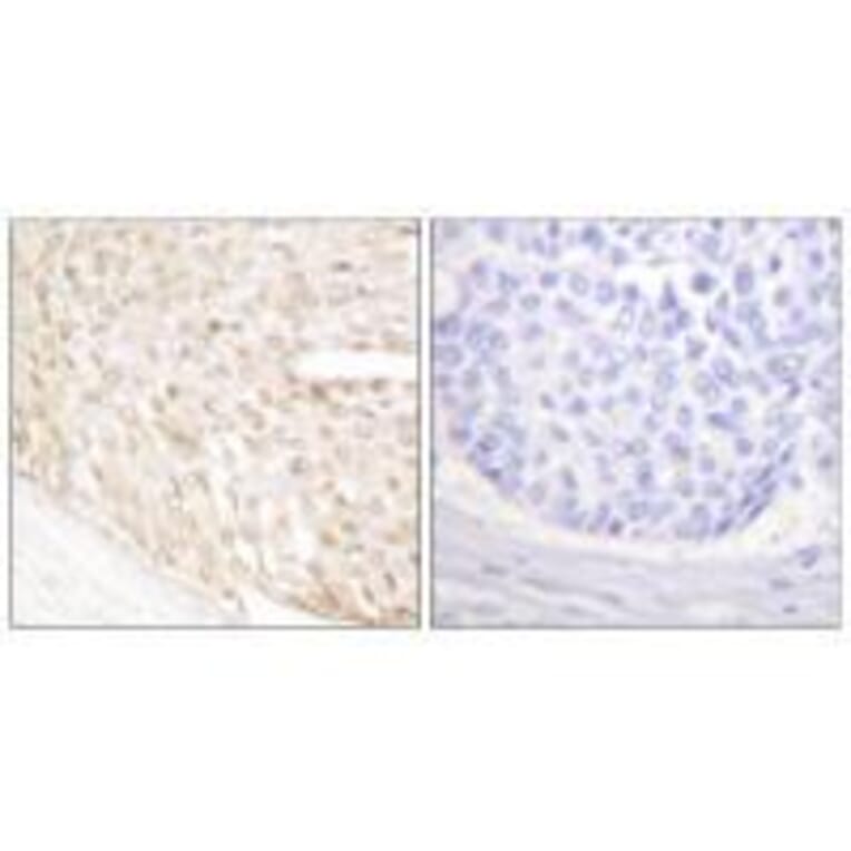 Immunohistochemistry - p18 INK Antibody from Signalway Antibody (33458) - Antibodies.com