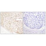 Immunohistochemistry - p18 INK Antibody from Signalway Antibody (33458) - Antibodies.com