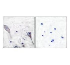 Immunohistochemistry - Patched Antibody from Signalway Antibody (33466) - Antibodies.com