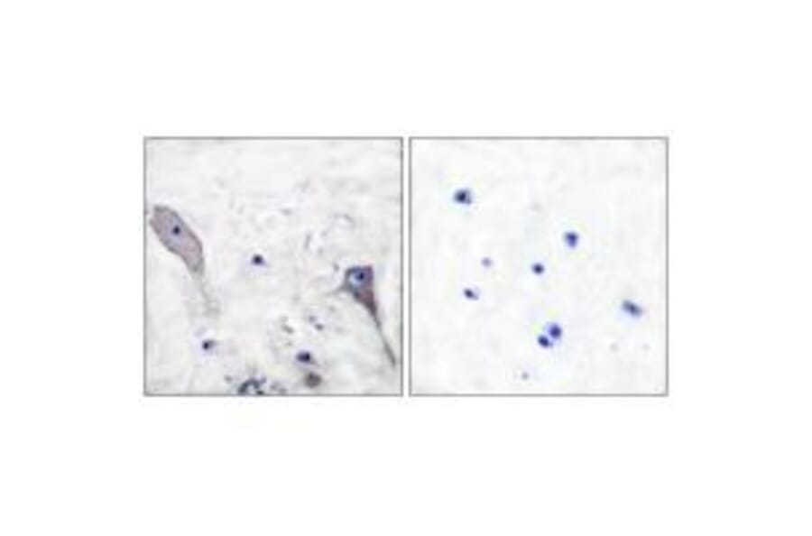 Immunohistochemistry - Patched Antibody from Signalway Antibody (33466) - Antibodies.com