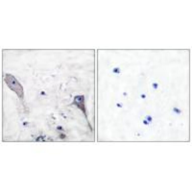 Immunohistochemistry - Patched Antibody from Signalway Antibody (33466) - Antibodies.com