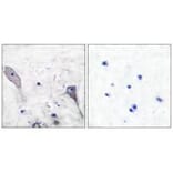 Immunohistochemistry - Patched Antibody from Signalway Antibody (33466) - Antibodies.com