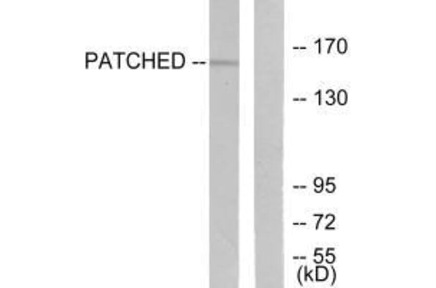 Western blot - Patched Antibody from Signalway Antibody (33466) - Antibodies.com