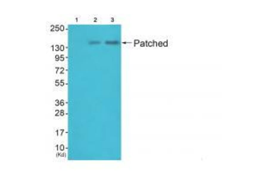 Western blot - Patched Antibody from Signalway Antibody (33466) - Antibodies.com