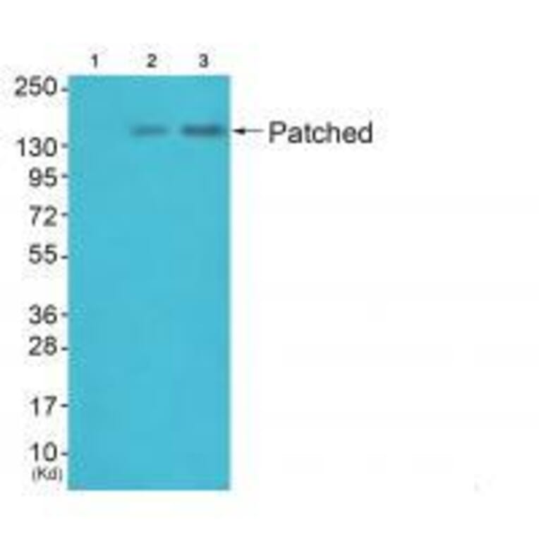 Western blot - Patched Antibody from Signalway Antibody (33466) - Antibodies.com