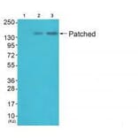 Western blot - Patched Antibody from Signalway Antibody (33466) - Antibodies.com