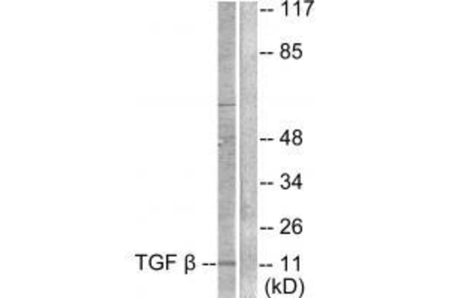 Western blot - TGF β3 Antibody from Signalway Antibody (33498) - Antibodies.com