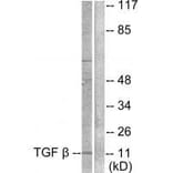 Western blot - TGF β3 Antibody from Signalway Antibody (33498) - Antibodies.com