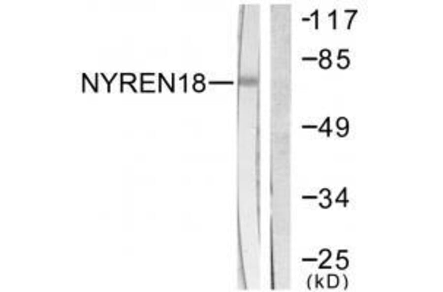 Western blot - NYREN18 Antibody from Signalway Antibody (33514) - Antibodies.com