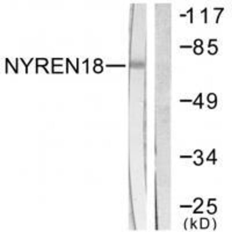 Western blot - NYREN18 Antibody from Signalway Antibody (33514) - Antibodies.com