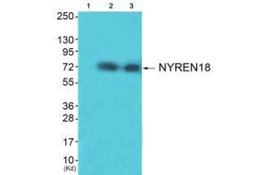 Western blot - NYREN18 Antibody from Signalway Antibody (33514) - Antibodies.com