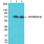 Western blot - NYREN18 Antibody from Signalway Antibody (33514) - Antibodies.com