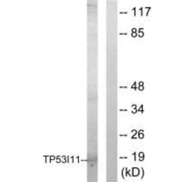 Western blot - TP53I11 Antibody from Signalway Antibody (33566) - Antibodies.com