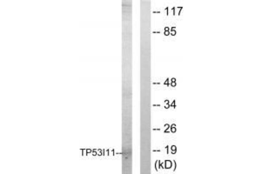 Western blot - TP53I11 Antibody from Signalway Antibody (33566) - Antibodies.com