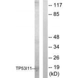 Western blot - TP53I11 Antibody from Signalway Antibody (33566) - Antibodies.com