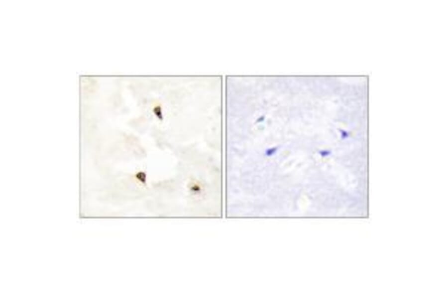 Immunohistochemistry - TP53I11 Antibody from Signalway Antibody (33566) - Antibodies.com