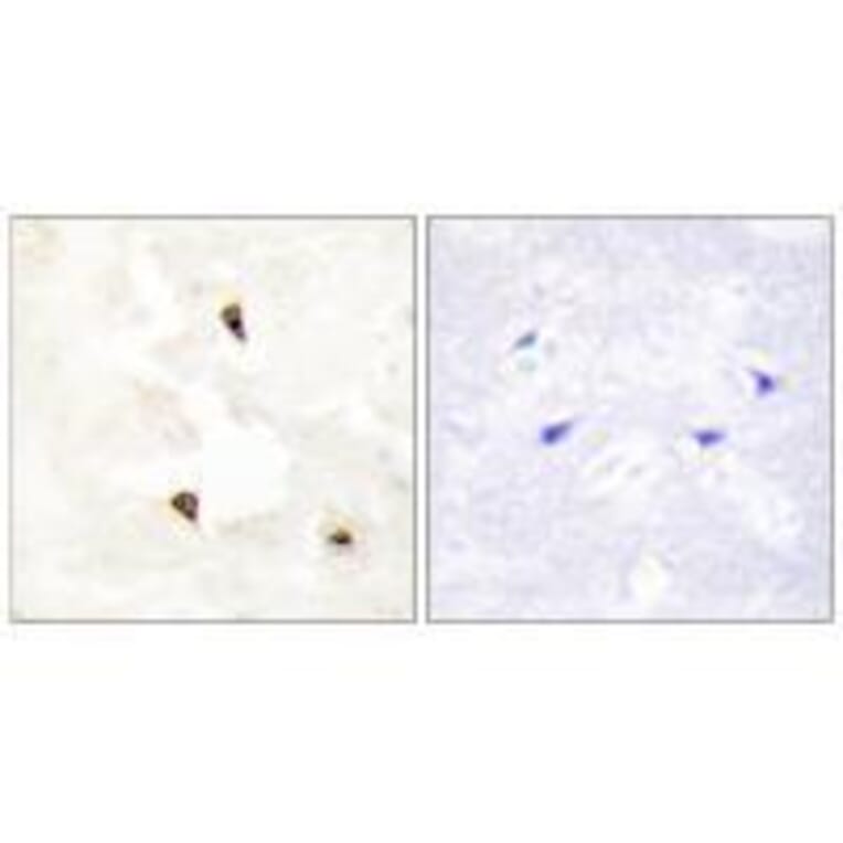 Immunohistochemistry - TP53I11 Antibody from Signalway Antibody (33566) - Antibodies.com