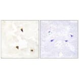 Immunohistochemistry - TP53I11 Antibody from Signalway Antibody (33566) - Antibodies.com