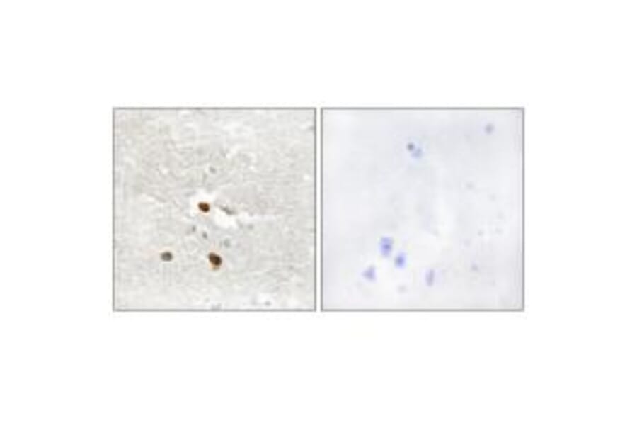 Immunohistochemistry - ZNF287 Antibody from Signalway Antibody (34071) - Antibodies.com
