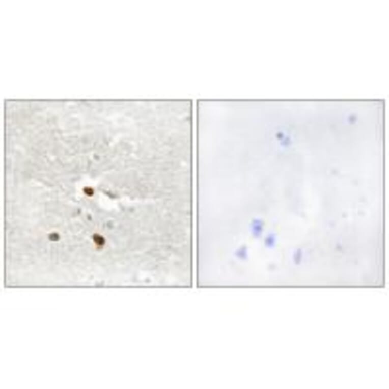 Immunohistochemistry - ZNF287 Antibody from Signalway Antibody (34071) - Antibodies.com