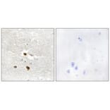 Immunohistochemistry - ZNF287 Antibody from Signalway Antibody (34071) - Antibodies.com