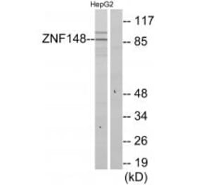 Western blot - ZNF148 Antibody from Signalway Antibody (34124) - Antibodies.com