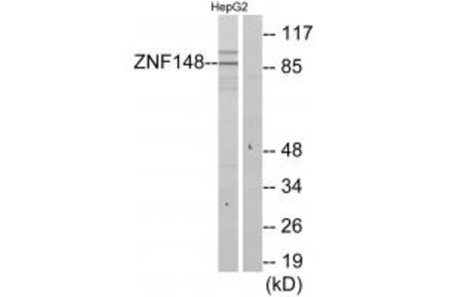 Western blot - ZNF148 Antibody from Signalway Antibody (34124) - Antibodies.com