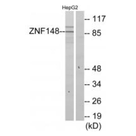 Western blot - ZNF148 Antibody from Signalway Antibody (34124) - Antibodies.com