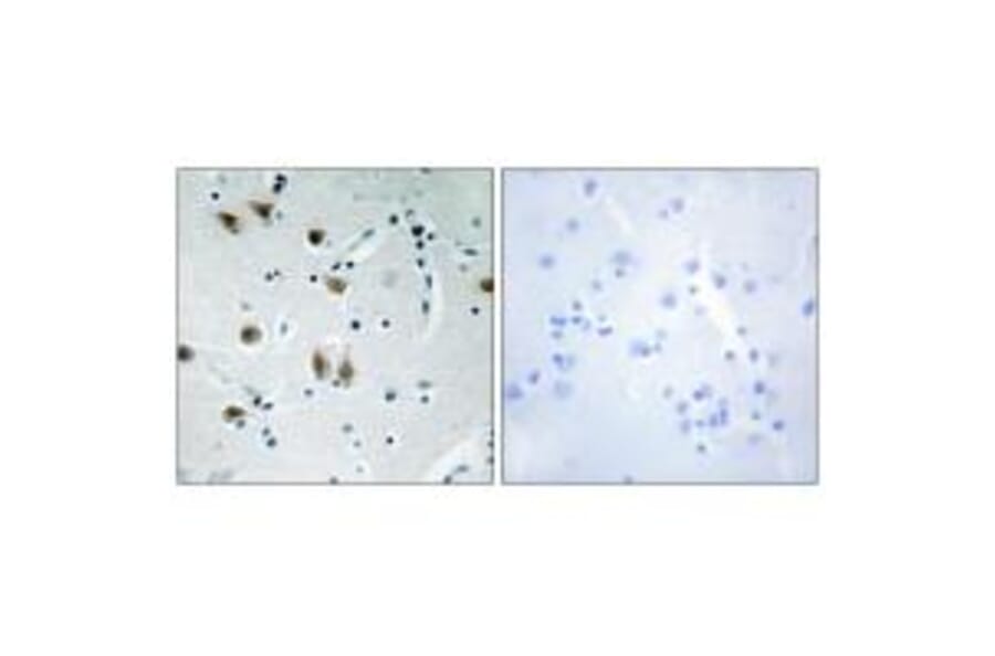 Immunohistochemistry - ZNF148 Antibody from Signalway Antibody (34124) - Antibodies.com
