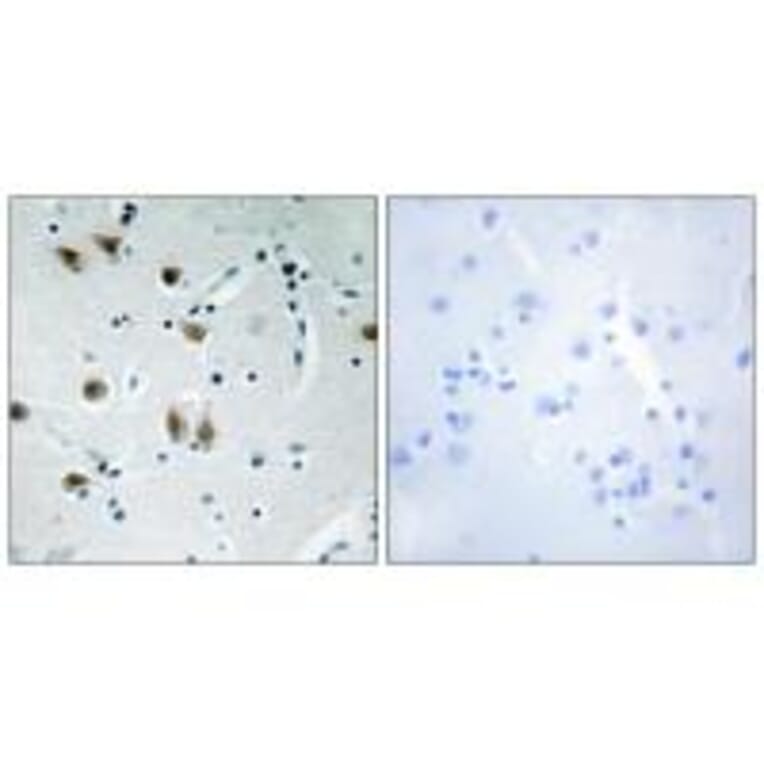 Immunohistochemistry - ZNF148 Antibody from Signalway Antibody (34124) - Antibodies.com