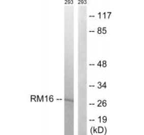 Western blot - MRPL16 Antibody from Signalway Antibody (34320) - Antibodies.com