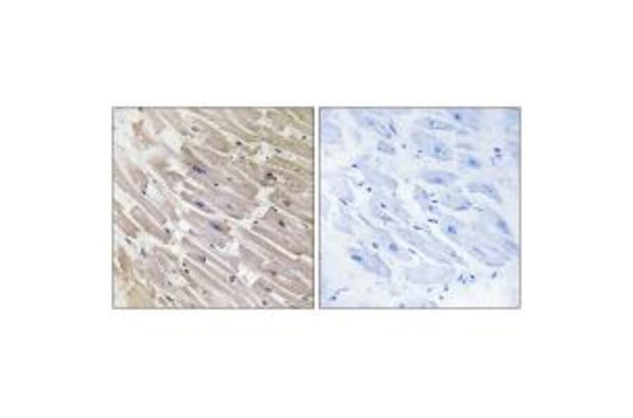 Immunohistochemistry - MRPL16 Antibody from Signalway Antibody (34320) - Antibodies.com