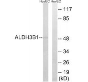 Western blot - ALDH3B1 Antibody from Signalway Antibody (34397) - Antibodies.com