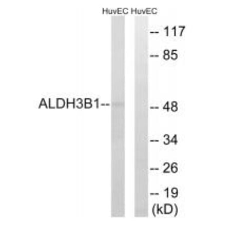 Western blot - ALDH3B1 Antibody from Signalway Antibody (34397) - Antibodies.com