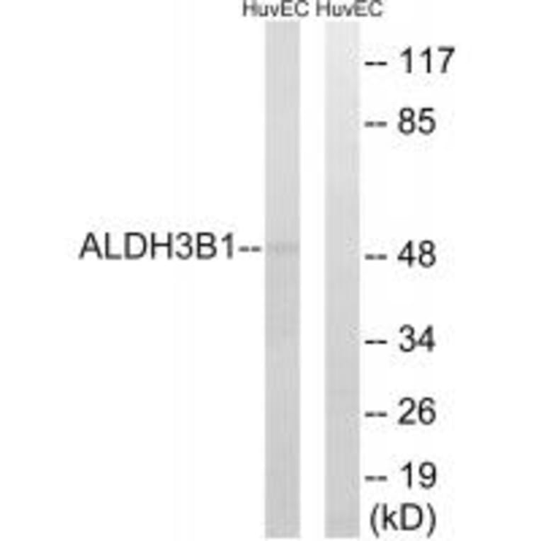 Western blot - ALDH3B1 Antibody from Signalway Antibody (34397) - Antibodies.com