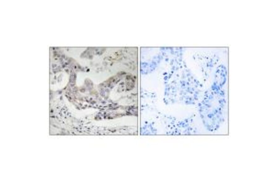Immunohistochemistry - ALDH3B1 Antibody from Signalway Antibody (34397) - Antibodies.com