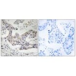 Immunohistochemistry - ALDH3B1 Antibody from Signalway Antibody (34397) - Antibodies.com