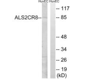 Western blot - ALS2CR8 Antibody from Signalway Antibody (34418) - Antibodies.com