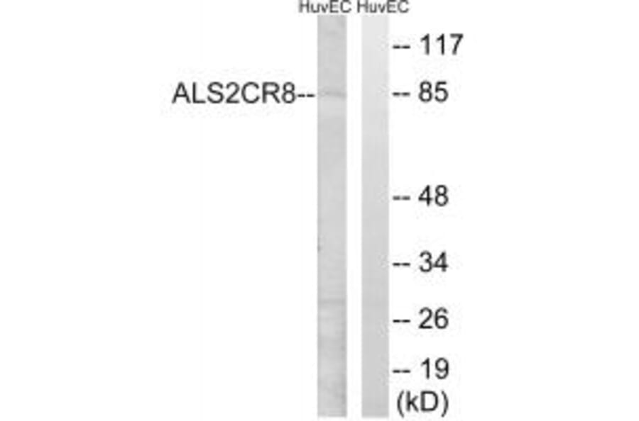 Western blot - ALS2CR8 Antibody from Signalway Antibody (34418) - Antibodies.com