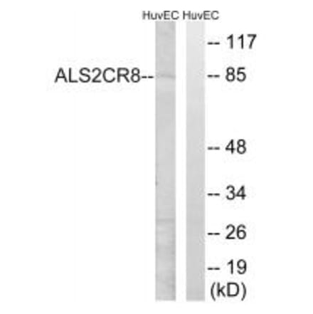 Western blot - ALS2CR8 Antibody from Signalway Antibody (34418) - Antibodies.com