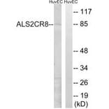 Western blot - ALS2CR8 Antibody from Signalway Antibody (34418) - Antibodies.com