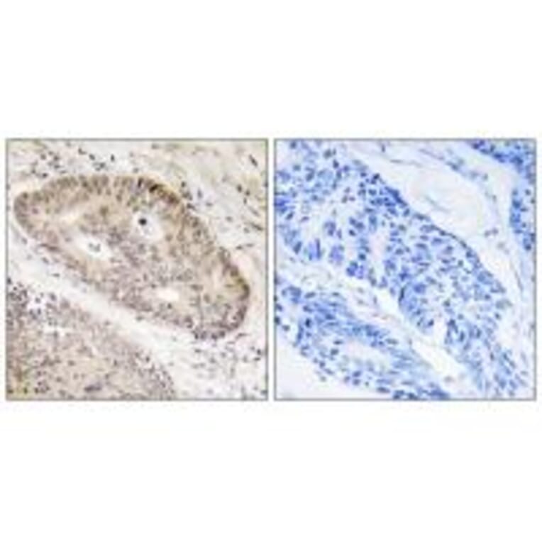 Immunohistochemistry - ALS2CR8 Antibody from Signalway Antibody (34418) - Antibodies.com