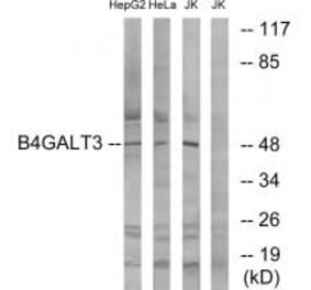 Western blot - B4GALT3 Antibody from Signalway Antibody (34493) - Antibodies.com