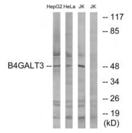 Western blot - B4GALT3 Antibody from Signalway Antibody (34493) - Antibodies.com